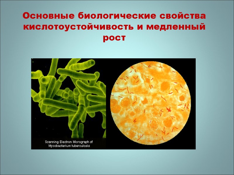 Основные биологические свойства кислотоустойчивость и медленный рост